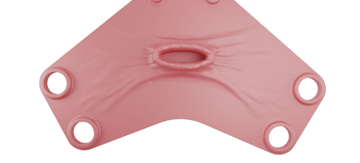 00000376 Vaginal Vault Closure1