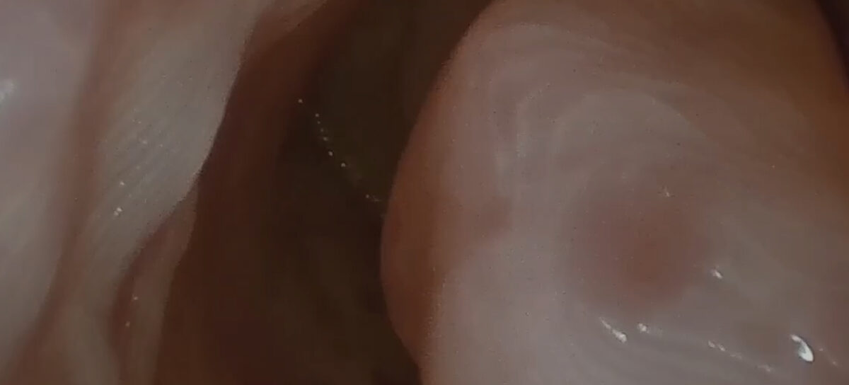 Anatomical landparks rpoc