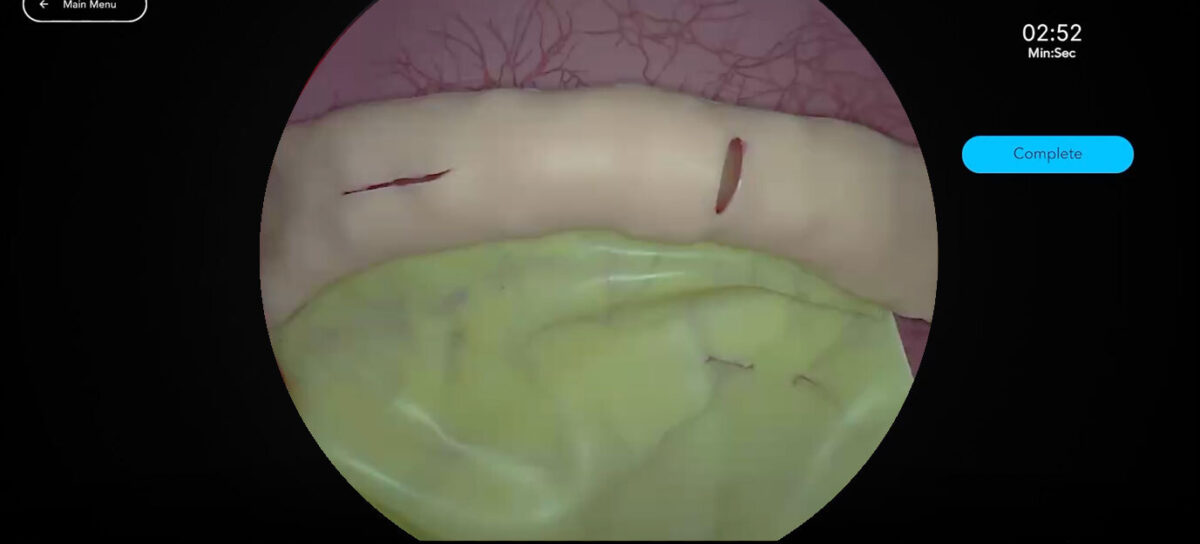 Bowel Enterotomy