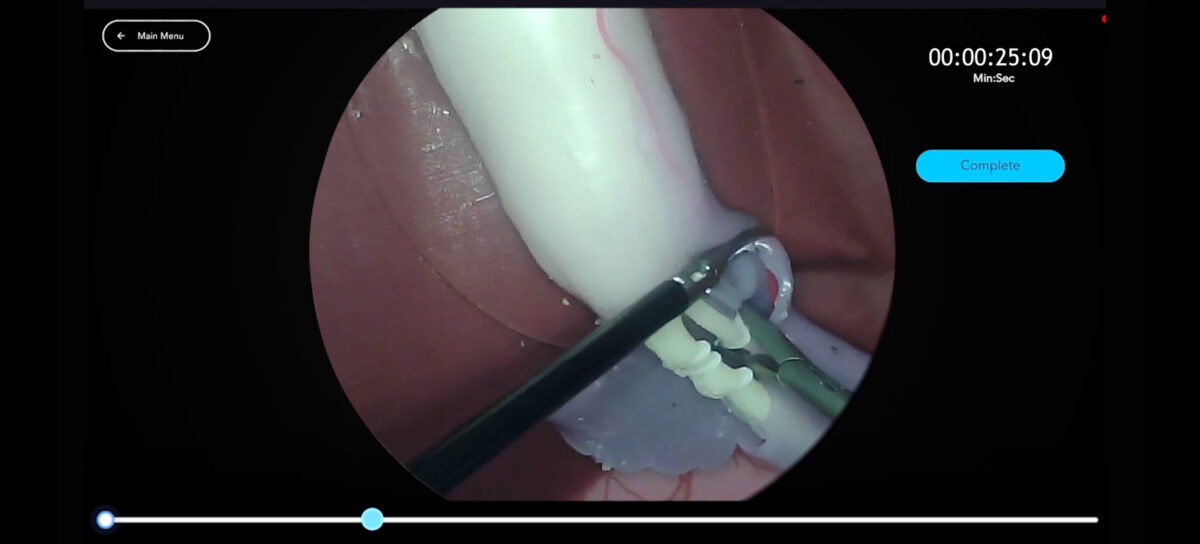 Cholecystectomy Header