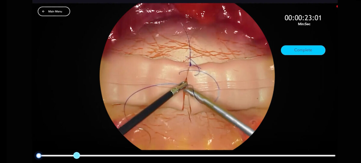 Header Bowel anastomosis