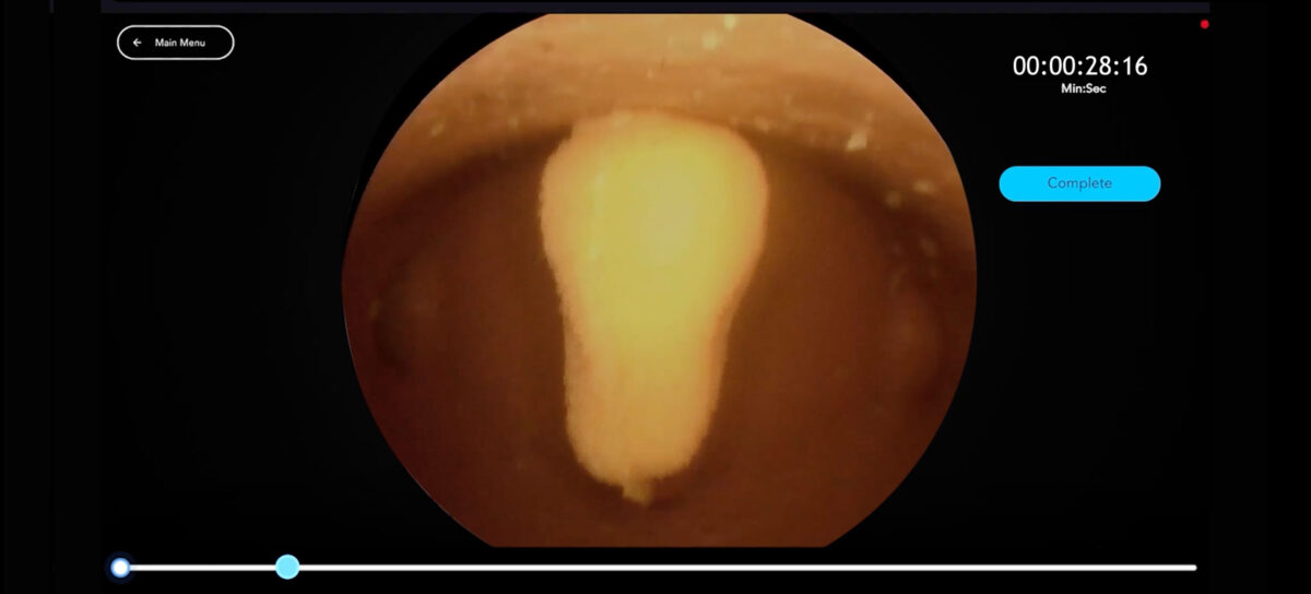 Header Hysteroscopic Polypectomy Dry Lab