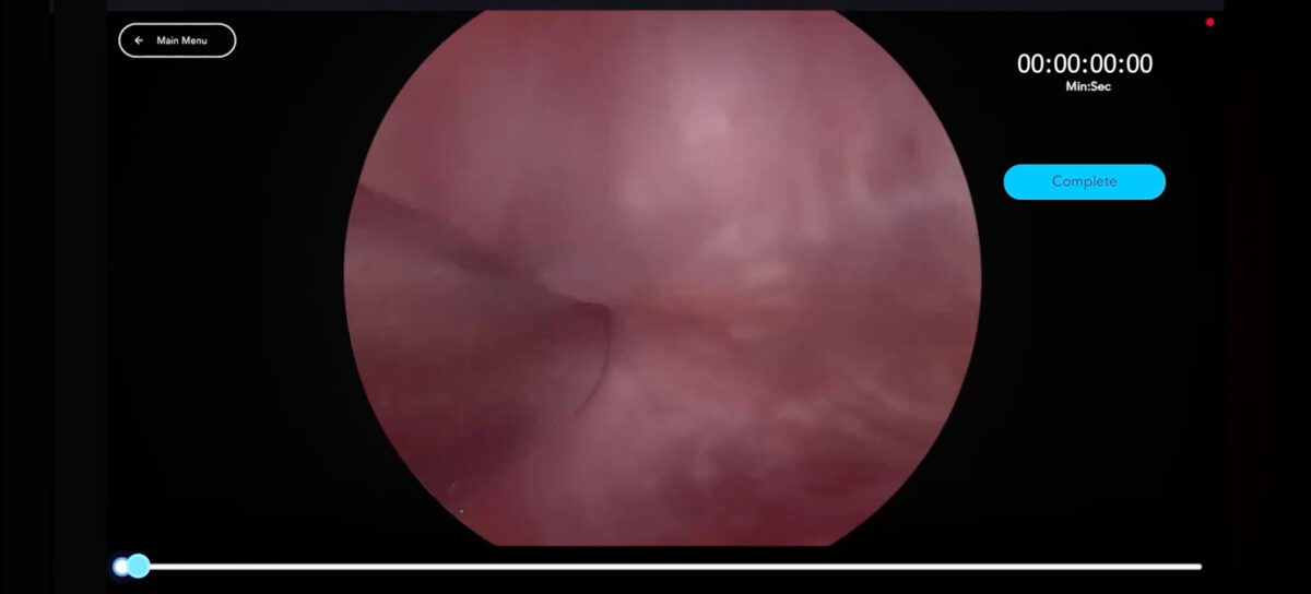 Header Hysteroscopic Visual DC