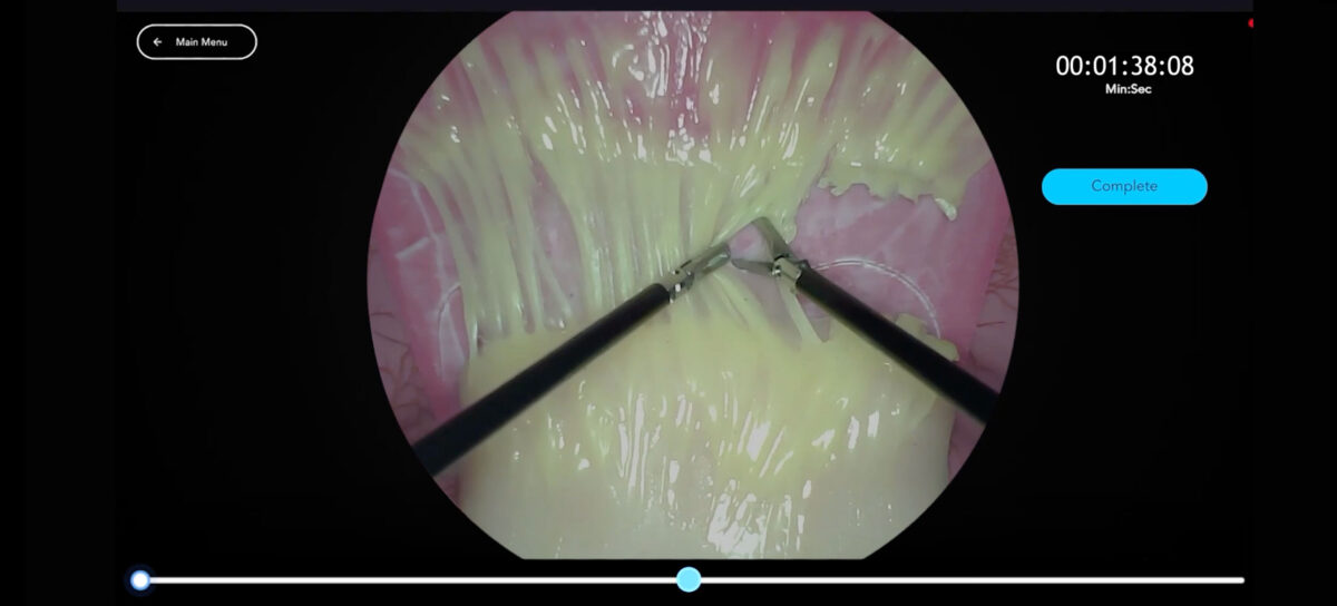 Header Laparoscopic Adhesiolysis