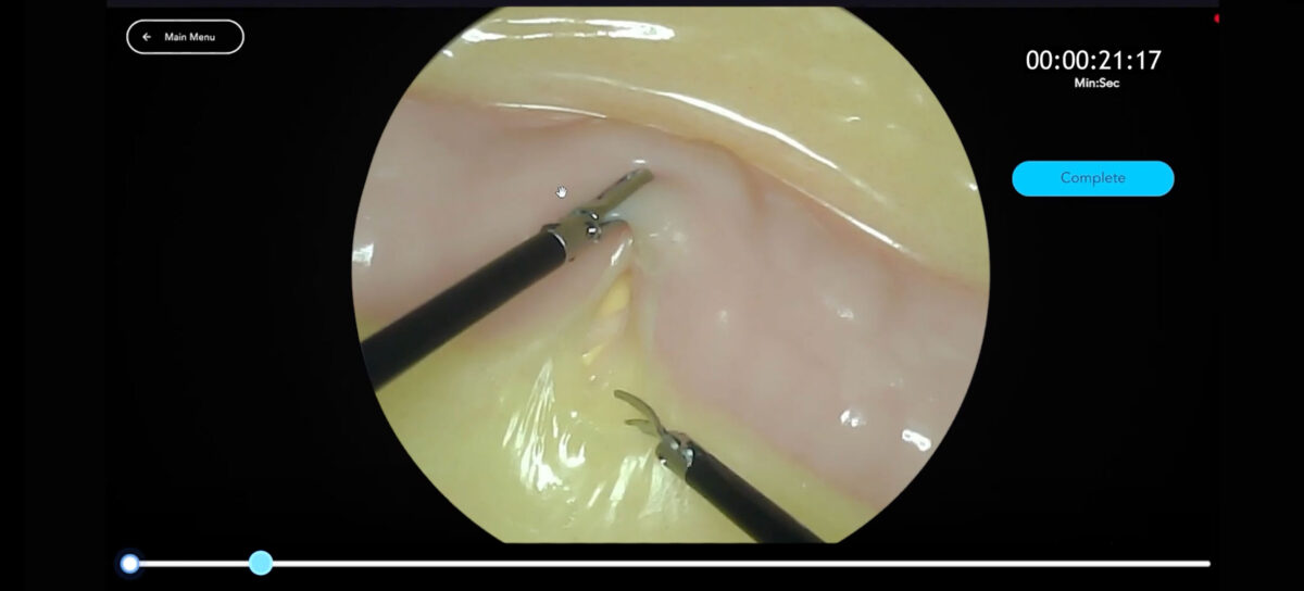 Header Mesocolic Dissection