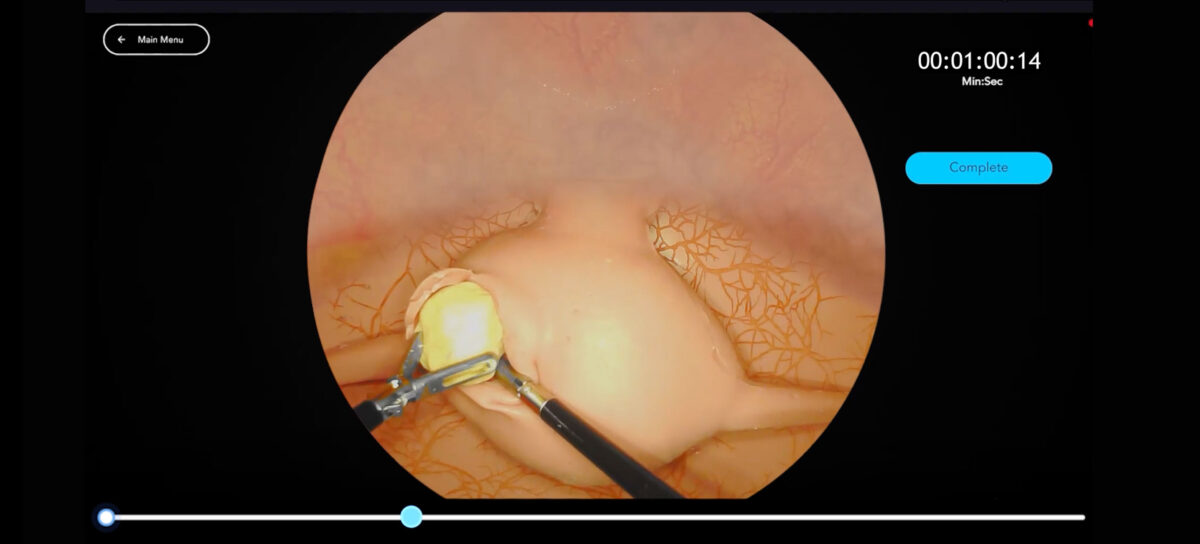 Header Myomectomy
