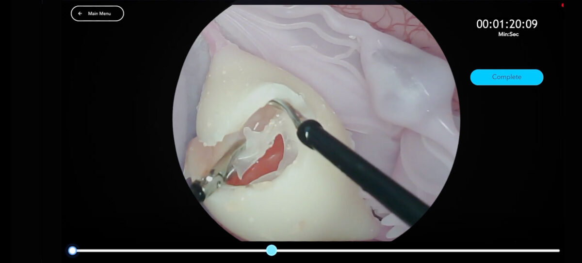 Header Ovarian Cystectomy