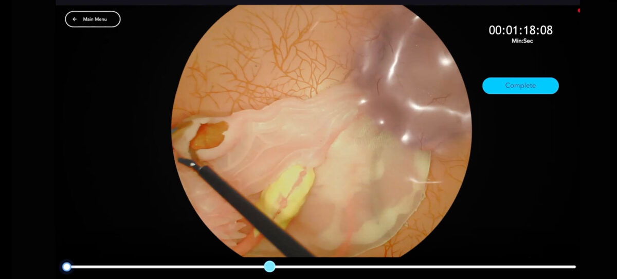 Header Salpingostomy