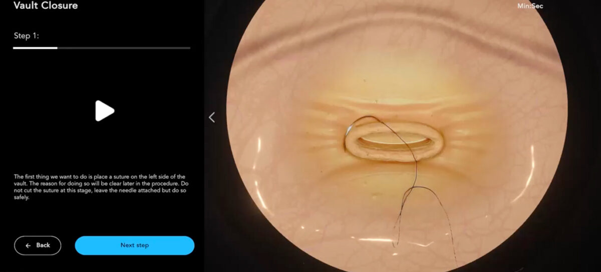 Vaginal Vault Closure